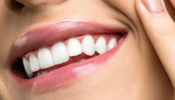 dientes amarillos manchas